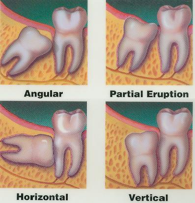 Oral-and-Maxillofacial-Surgeries